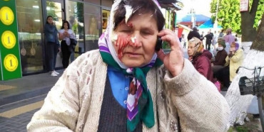 У Костополі власниця салону розбила бабусі голову